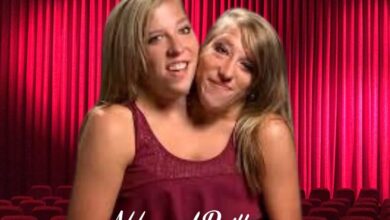 abby und brittany hensel tot